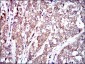 RAF1 Antibody
